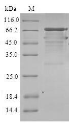 STEAP2 Protein - (Tris-Glycine gel) Discontinuous SDS-PAGE (reduced) with 5% enrichment gel and 15% separation gel.
