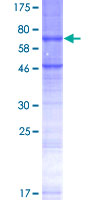 STEAP2 Protein - 12.5% SDS-PAGE of human STEAP2 stained with Coomassie Blue