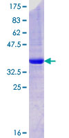 STEAP2 Protein - 12.5% SDS-PAGE Stained with Coomassie Blue.