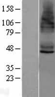 STEAP4 Protein - Western validation with an anti-DDK antibody * L: Control HEK293 lysate R: Over-expression lysate