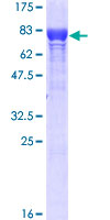 STI1 / STIP1 Protein - 12.5% SDS-PAGE of human STIP1 stained with Coomassie Blue