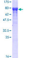 STI1 / STIP1 Protein - 12.5% SDS-PAGE of human STIP1 stained with Coomassie Blue