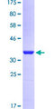 STI1 / STIP1 Protein - 12.5% SDS-PAGE Stained with Coomassie Blue.