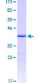 STI1 / STIP1 Protein - 12.5% SDS-PAGE Stained with Coomassie Blue