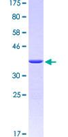 STI1 / STIP1 Protein - 12.5% SDS-PAGE Stained with Coomassie Blue.
