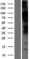 STIM2 Protein - Western validation with an anti-DDK antibody * L: Control HEK293 lysate R: Over-expression lysate