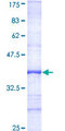STK10 / LOK Protein - 12.5% SDS-PAGE Stained with Coomassie Blue.