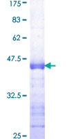 STK11 / LKB1 Protein - 12.5% SDS-PAGE Stained with Coomassie Blue.