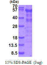 STK11 / LKB1 Protein