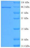 STK11 / LKB1 Protein