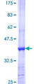 STK11IP Protein - 12.5% SDS-PAGE Stained with Coomassie Blue.