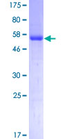 STK16 Protein - 12.5% SDS-PAGE of human STK16 stained with Coomassie Blue