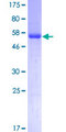 STK16 Protein - 12.5% SDS-PAGE of human STK16 stained with Coomassie Blue