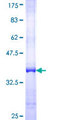 STK16 Protein - 12.5% SDS-PAGE Stained with Coomassie Blue.
