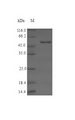 STK16 Protein - (Tris-Glycine gel) Discontinuous SDS-PAGE (reduced) with 5% enrichment gel and 15% separation gel.