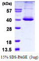 STK16 Protein