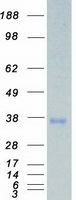 STK16 Protein - Purified recombinant protein STK16 was analyzed by SDS-PAGE gel and Coomassie Blue Staining