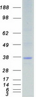 STK16 Protein - Purified recombinant protein STK16 was analyzed by SDS-PAGE gel and Coomassie Blue Staining