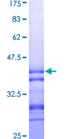 STK17B / DRAK2 Protein - 12.5% SDS-PAGE Stained with Coomassie Blue.