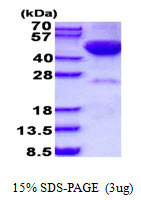 STK17B / DRAK2 Protein