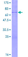STK19 Protein - 12.5% SDS-PAGE of human STK19 stained with Coomassie Blue