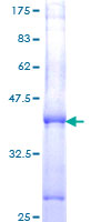STK19 Protein - 12.5% SDS-PAGE Stained with Coomassie Blue.