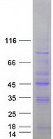 STK19 Protein - Purified recombinant protein STK19 was analyzed by SDS-PAGE gel and Coomassie Blue Staining