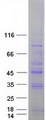 STK19 Protein - Purified recombinant protein STK19 was analyzed by SDS-PAGE gel and Coomassie Blue Staining