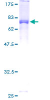 STK24 / MST3 Protein - 12.5% SDS-PAGE of human STK24 stained with Coomassie Blue