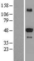 STK25 Protein - Western validation with an anti-DDK antibody * L: Control HEK293 lysate R: Over-expression lysate