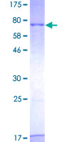 STK25 Protein - 12.5% SDS-PAGE of human STK25 stained with Coomassie Blue