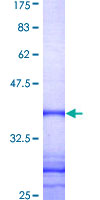 STK25 Protein - 12.5% SDS-PAGE Stained with Coomassie Blue.