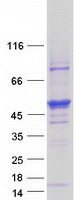 STK25 Protein - Purified recombinant protein STK25 was analyzed by SDS-PAGE gel and Coomassie Blue Staining
