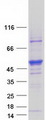 STK25 Protein - Purified recombinant protein STK25 was analyzed by SDS-PAGE gel and Coomassie Blue Staining