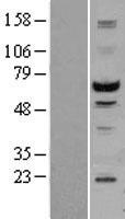 STK3 Protein - Western validation with an anti-DDK antibody * L: Control HEK293 lysate R: Over-expression lysate