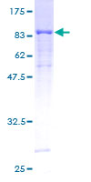 STK3 Protein - 12.5% SDS-PAGE of human STK3 stained with Coomassie Blue