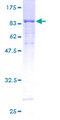 STK3 Protein - 12.5% SDS-PAGE of human STK3 stained with Coomassie Blue