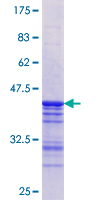 STK3 Protein - 12.5% SDS-PAGE Stained with Coomassie Blue.