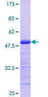 STK3 Protein - 12.5% SDS-PAGE Stained with Coomassie Blue.