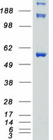 STK3 Protein - Purified recombinant protein STK3 was analyzed by SDS-PAGE gel and Coomassie Blue Staining