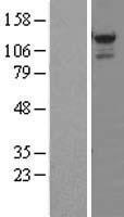 STK31 Protein - Western validation with an anti-DDK antibody * L: Control HEK293 lysate R: Over-expression lysate
