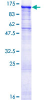 STK31 Protein - 12.5% SDS-PAGE of human STK31 stained with Coomassie Blue
