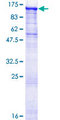 STK31 Protein - 12.5% SDS-PAGE of human STK31 stained with Coomassie Blue