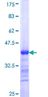 STK31 Protein - 12.5% SDS-PAGE Stained with Coomassie Blue.