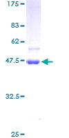 STK32A Protein - 12.5% SDS-PAGE of human STK32A stained with Coomassie Blue