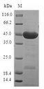 STK32A Protein - (Tris-Glycine gel) Discontinuous SDS-PAGE (reduced) with 5% enrichment gel and 15% separation gel.