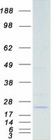 STK32A Protein - Purified recombinant protein STK32A was analyzed by SDS-PAGE gel and Coomassie Blue Staining