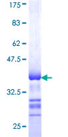 STK32B Protein - 12.5% SDS-PAGE Stained with Coomassie Blue.