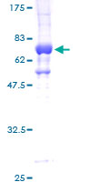 STK32C / PKE Protein - 12.5% SDS-PAGE of human STK32C stained with Coomassie Blue