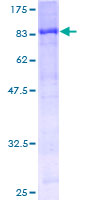 STK33 Protein - 12.5% SDS-PAGE of human STK33 stained with Coomassie Blue